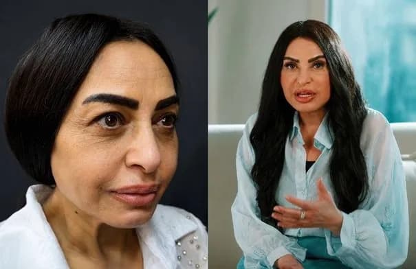 سلوى خطاب تكشف تفاصيل خضوعها لعملية تجميل شملت الوجه والرقبة