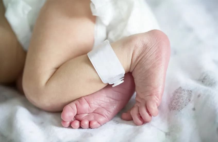 ولادة طفل بأربعة أذرع وأربعة أرجل في الهند في حالة نادرة من التوأم الطفيلي