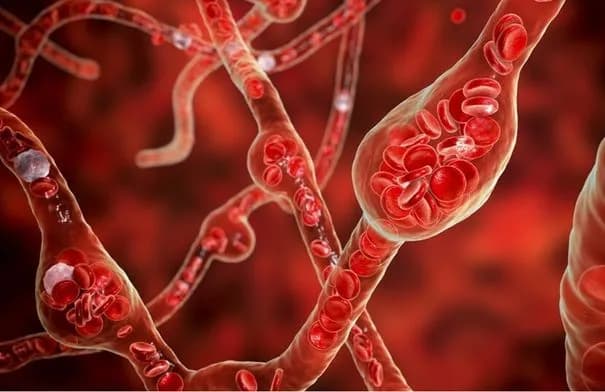 دراسة: 8 مواد حافظة شائعة قد ترتبط بارتفاع ضغط الدم وأمراض القلب