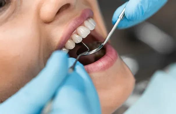 5 علامات تحذيرية في أسنانك لا ينبغي تجاهلها
