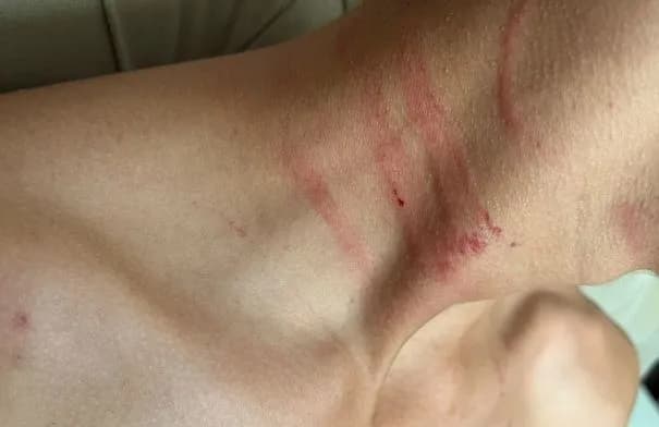 والد طالب في عمان يشكو تعرض نجله لضرب مبرح من معلم في مدرسة خاصة