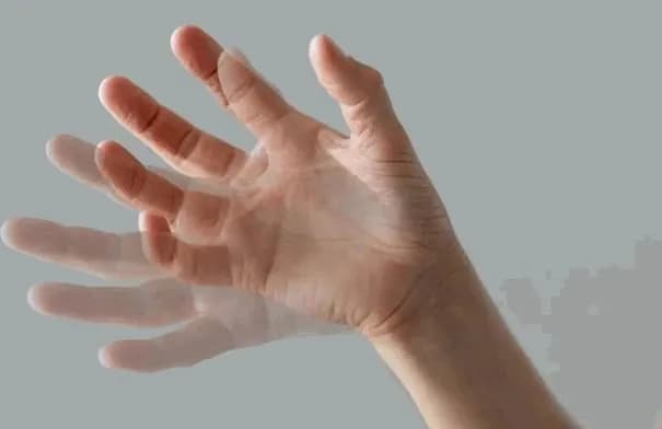 رعشة اليدين قد تنذر بانخفاض سكر الدم لدى مرضى السكري
