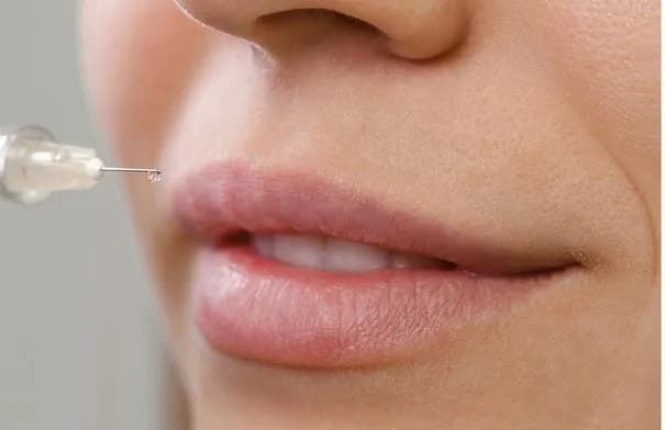 الفرق بين تقنية Lip Flip وفيلر الشفاه: أيهما يناسبك؟